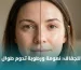 أفضل مرطب للبشرة الجافة