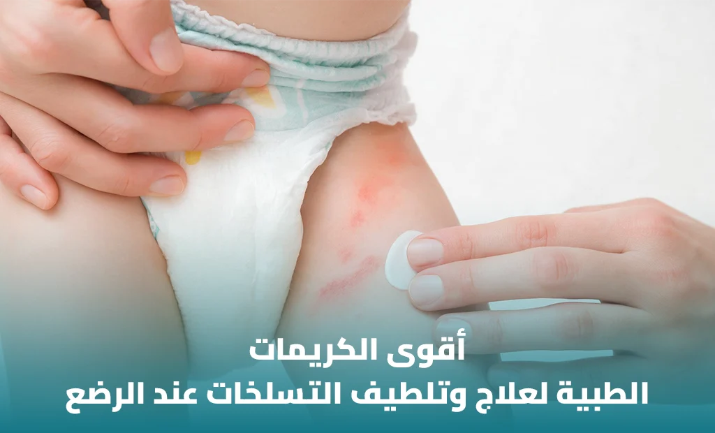 أفضل كريم لعلاج حساسية الحفاض .