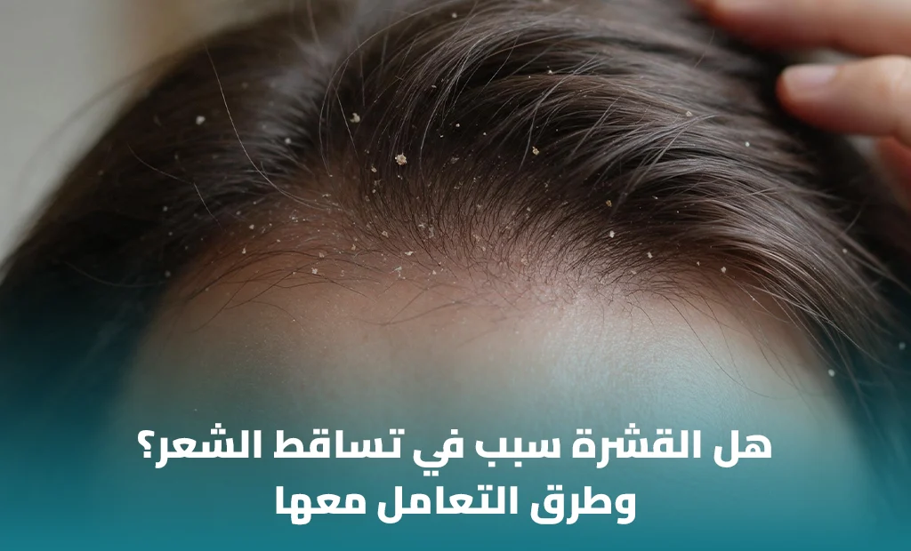 سبب في تساقط الشعر